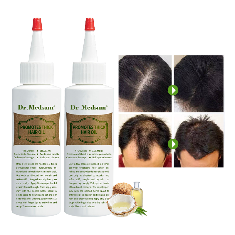 Natural hair growth oil bottle for scalp care and hair thickening